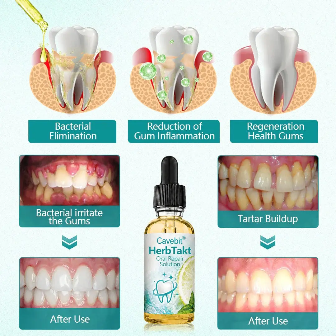HerbTakt Oral Repair Solution - Image 6