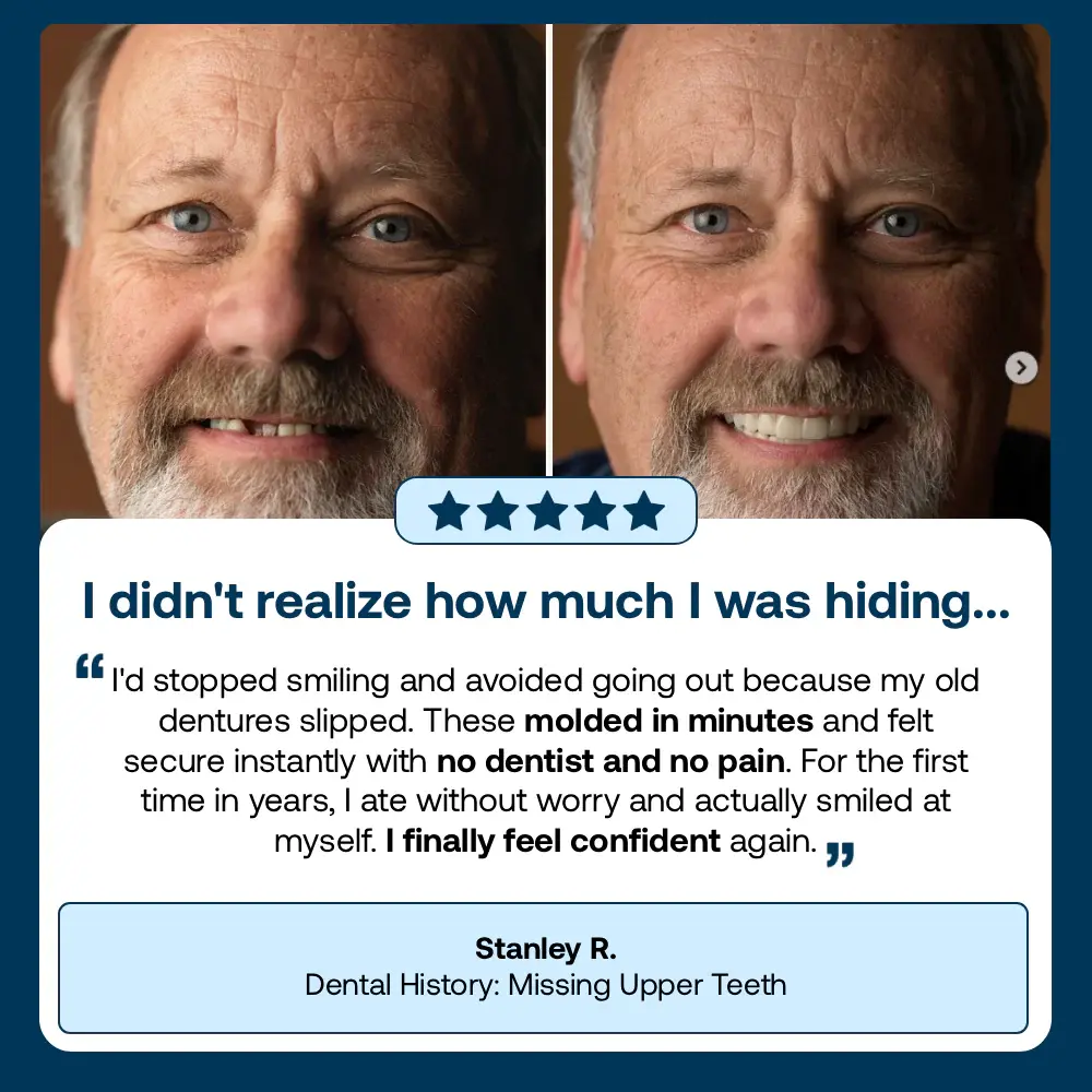 Full Denture with Strong Suctiond - Image 15