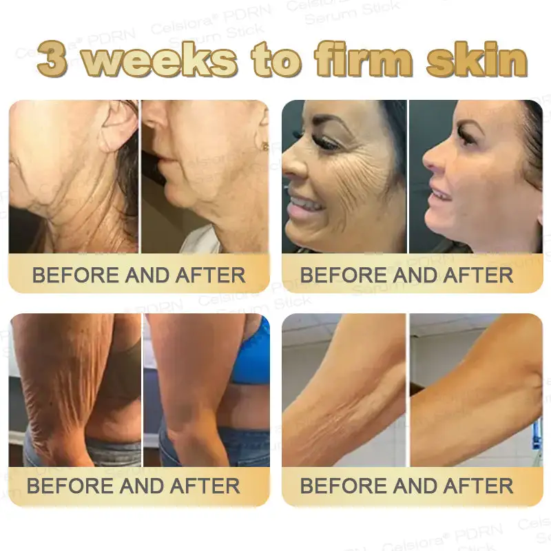 PDRN Multi-Peptide Firming Serum Stick - Image 4
