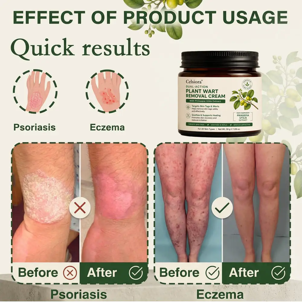 SkinRepair Essence Cream - Image 11