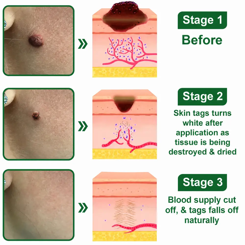 SkinRepair Essence Cream - Image 9