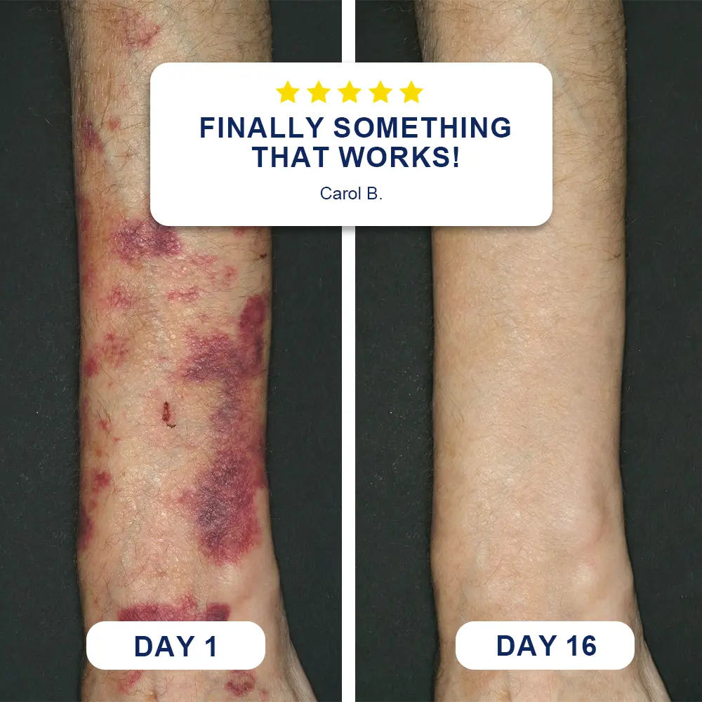 Bruise Repair & Skin-Strengthening Cream - Image 2