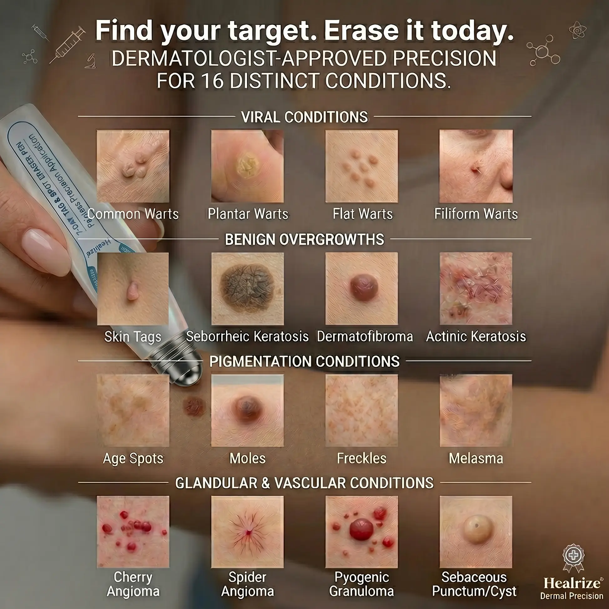7-Day Skin Tag & Spot Eraser Painless & Scar-Free Advanced Imperfection Removal Rollerball Pen - Image 4