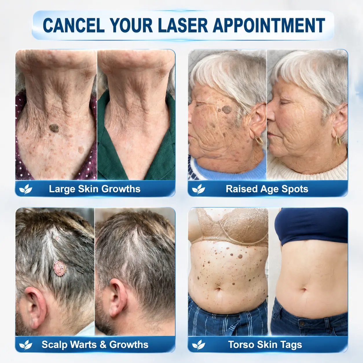 Skin Tag & Spot Appearance Support Pen - Image 2