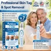 𝟕-𝐃𝒂𝘆 𝐒𝗸𝐢𝐧 𝐓𝒂𝗴 & 𝐒𝐩𝙤𝐭 𝐄𝐫𝒂𝐬𝙚𝐫 Painless & Scar-Free Advanced Imperfection Remova𝗜 Ro𝗜𝗜erba𝗜𝗜 Pen