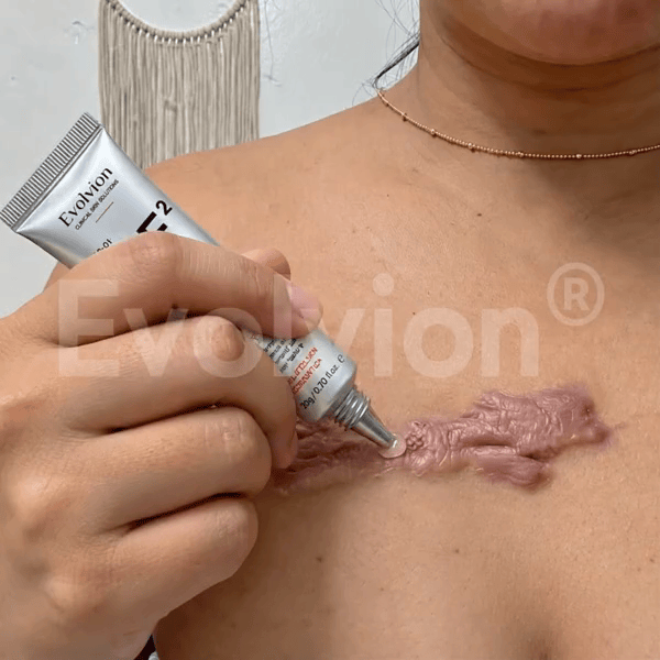Evolviion Advanced Bioactive Repair Gel - Image 9