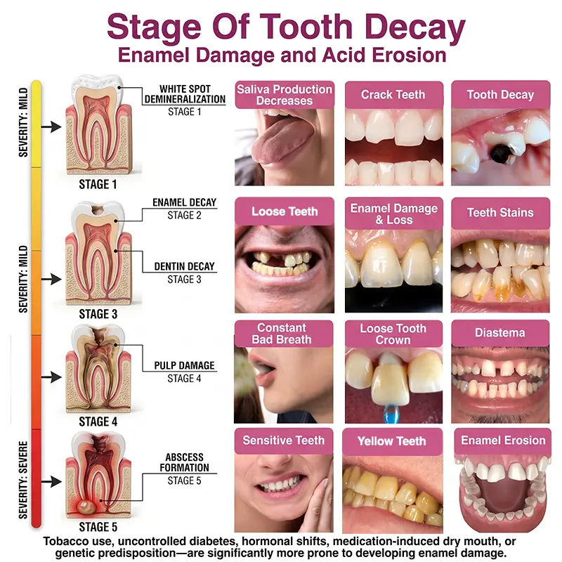 KLENIMORE DenPerm Cavity-Repair Natural Gel - Image 6