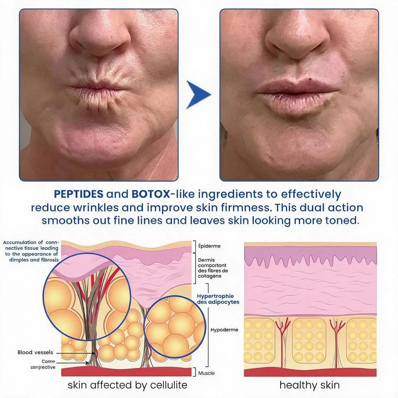 PDRN Anti-Wrinkle Cream - Image 11