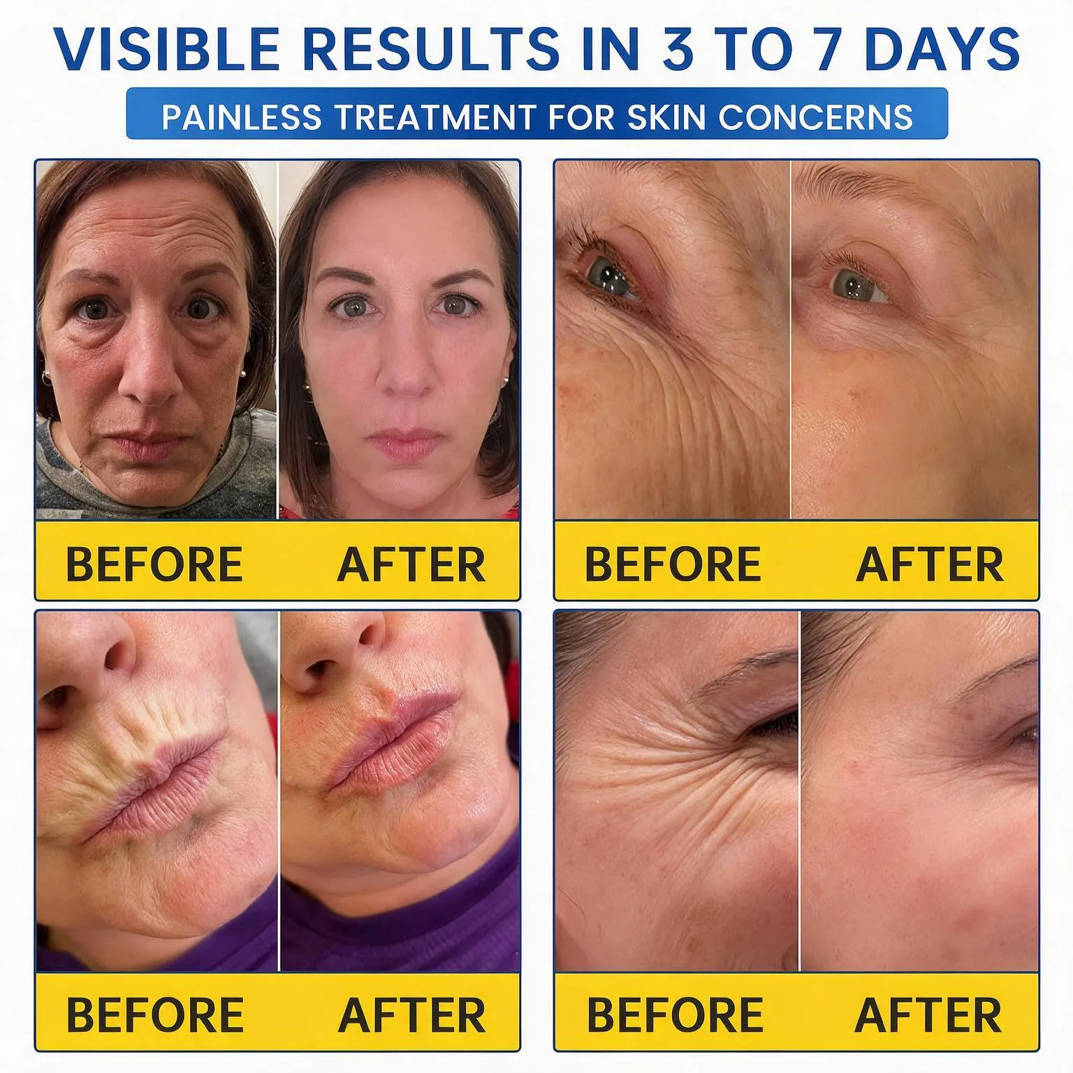 PDRN Anti-Wrinkle Cream - Image 3