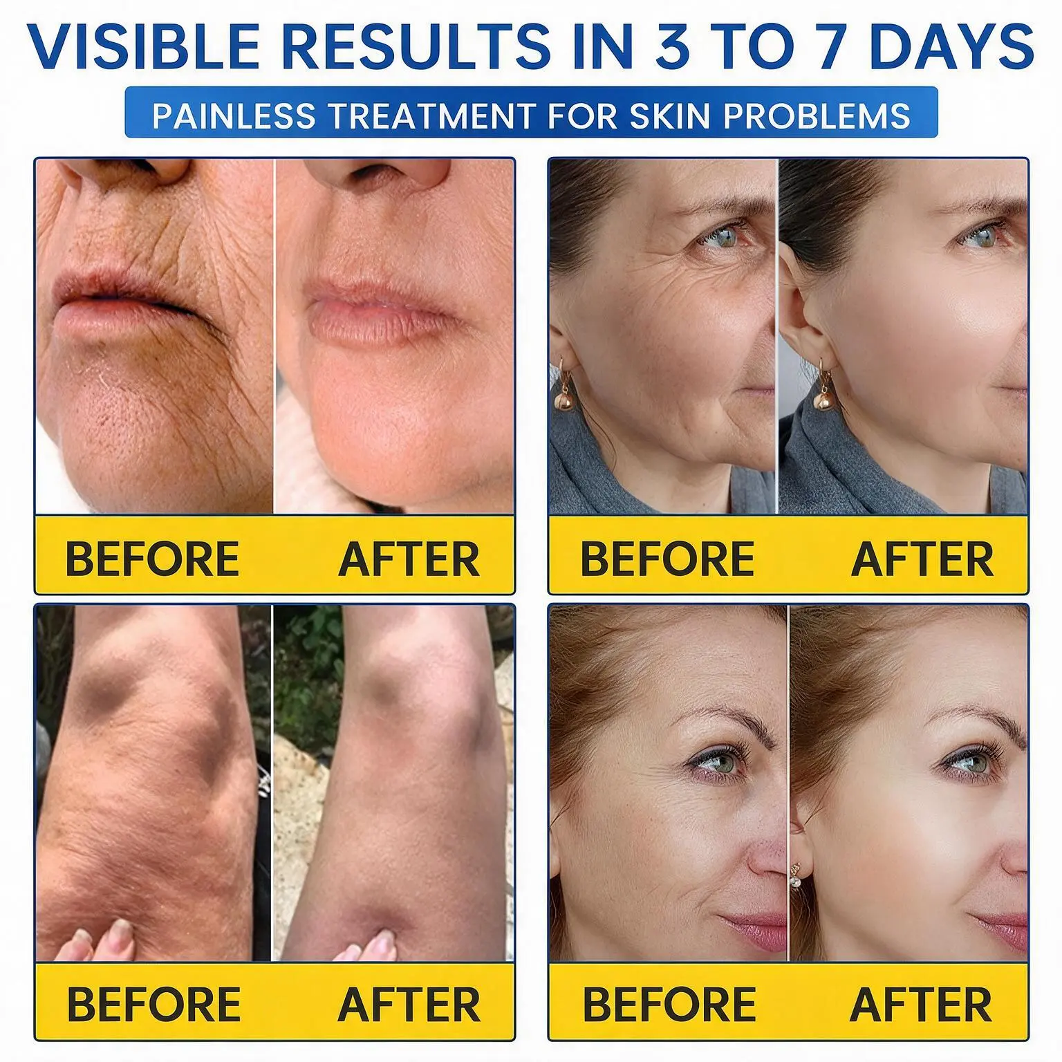 PDRN Anti-Wrinkle Cream - Image 4