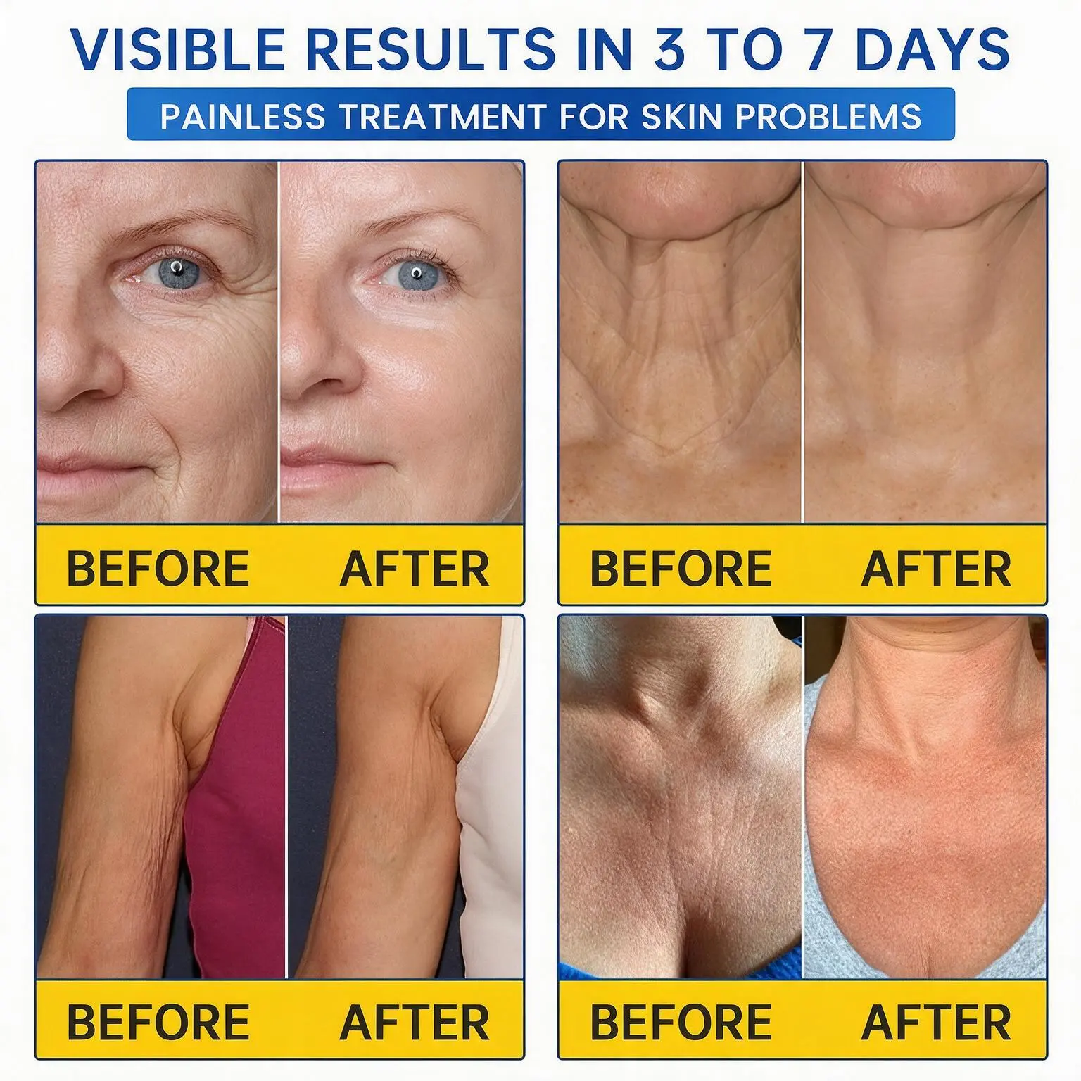 PDRN Anti-Wrinkle Cream - Image 5