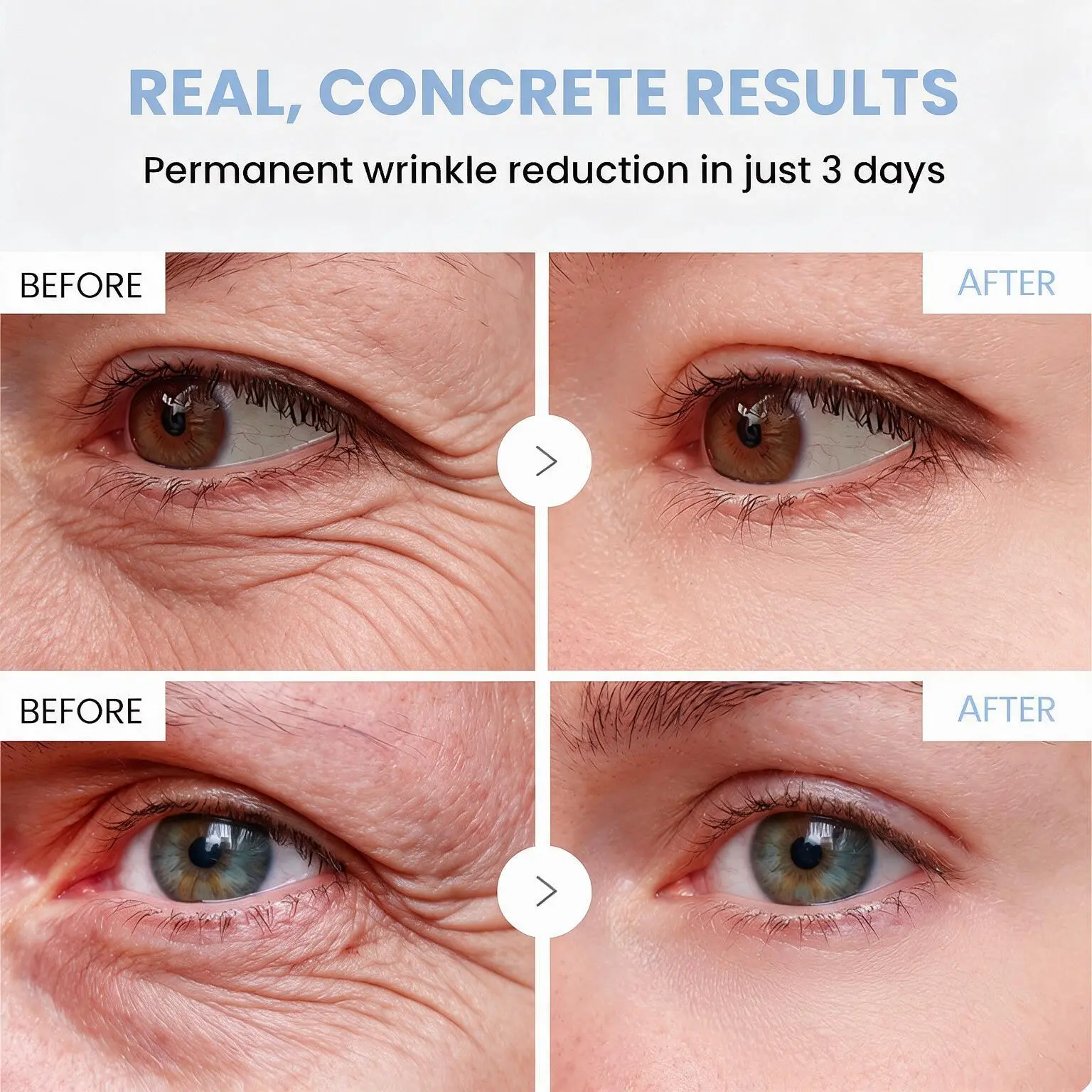 PDRN Anti-Wrinkle Cream - Image 8