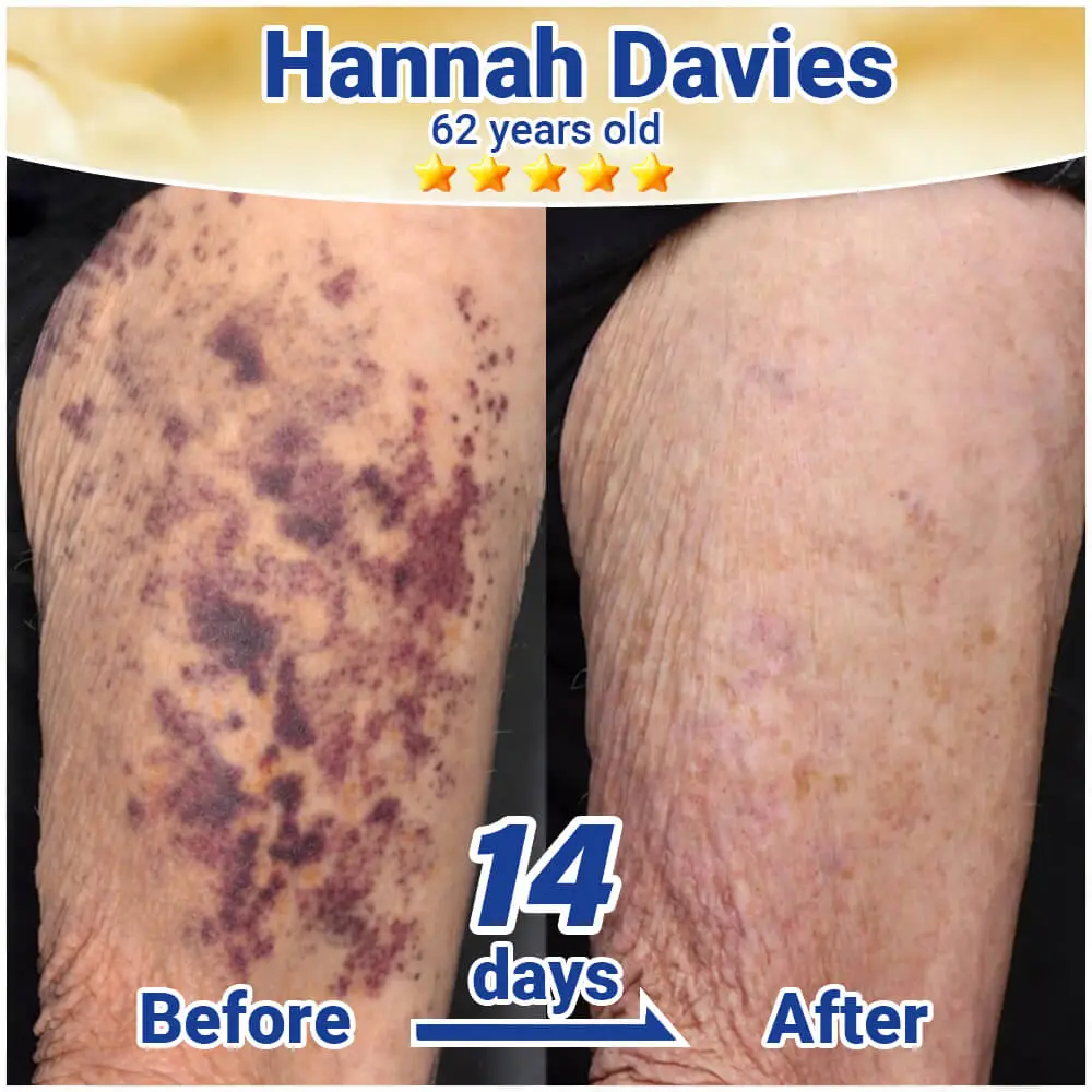BruiseRepair & Skin-Strengthening Cream - Image 14