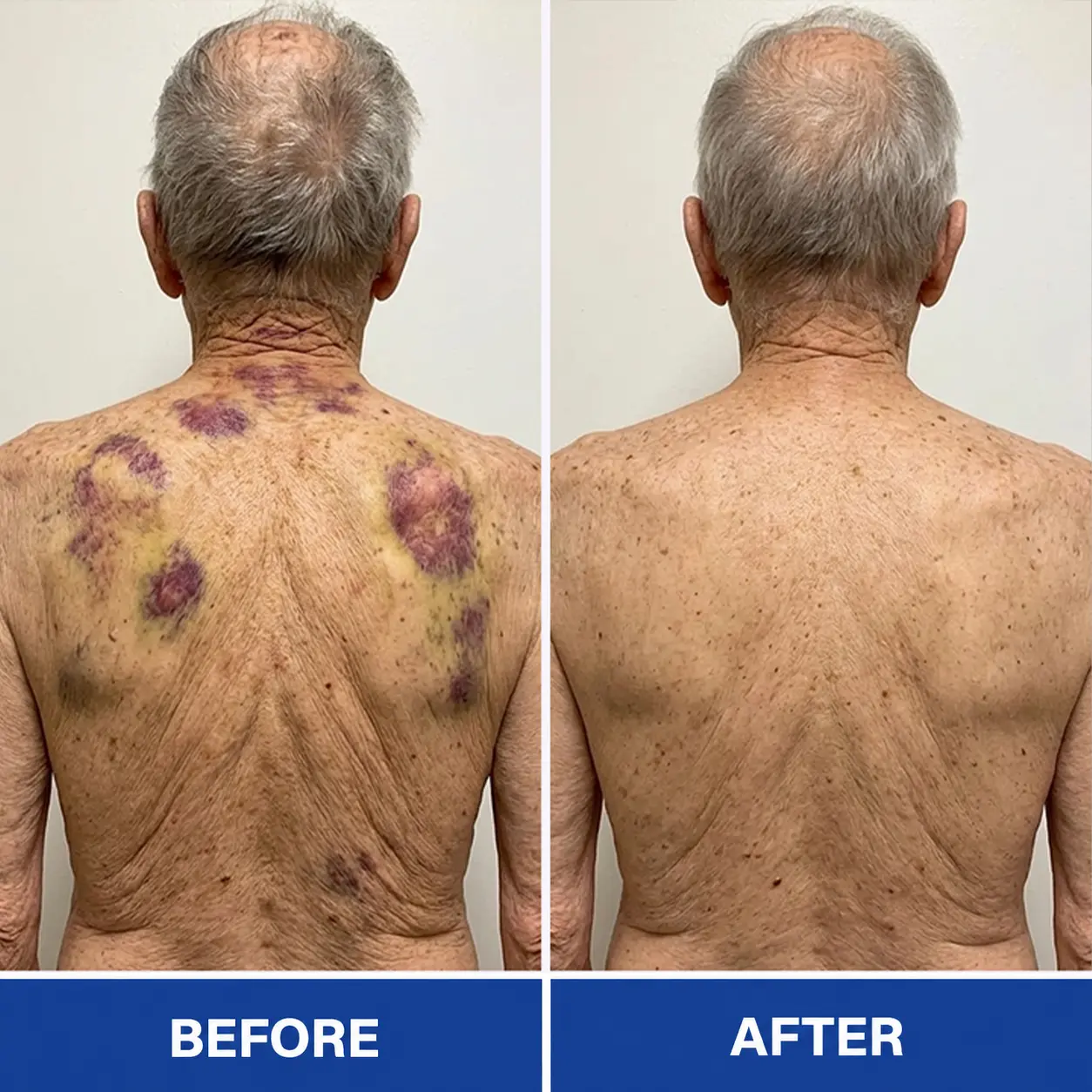 BruiseRepair & Skin-Strengthening Cream - Image 6