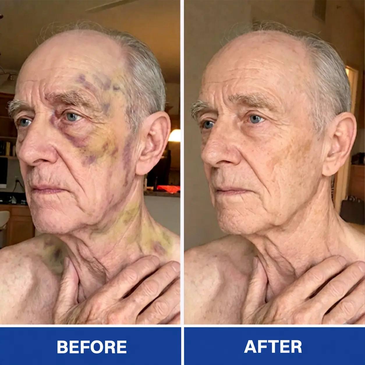 BruiseRepair & Skin-Strengthening Cream - Image 7