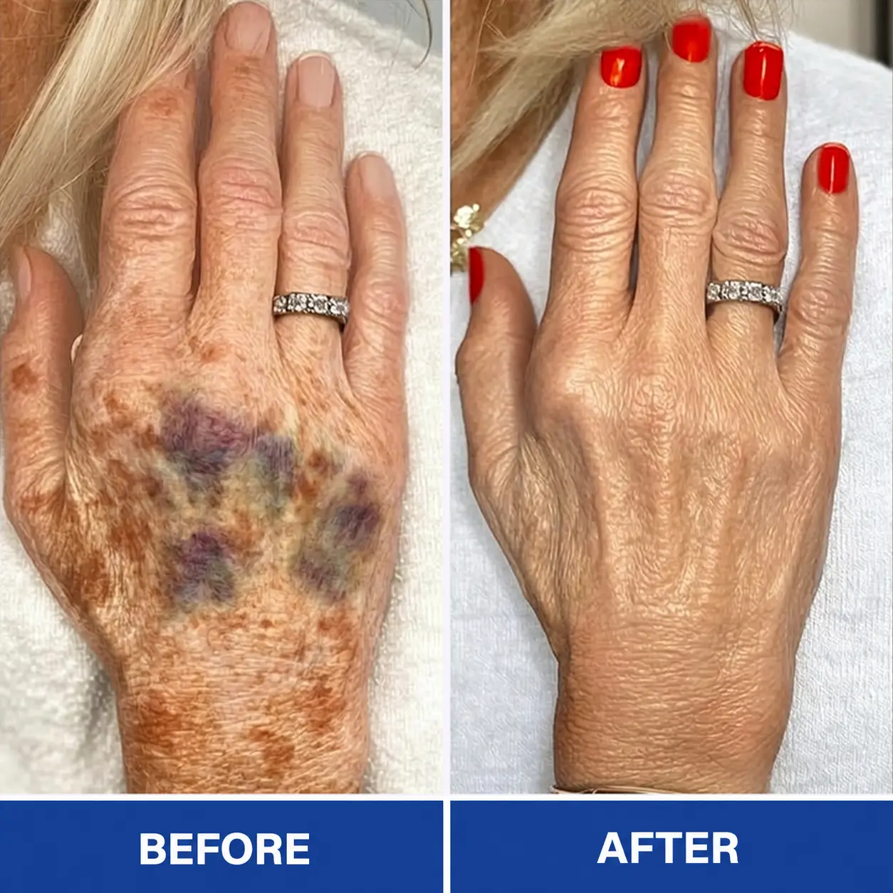 BruiseRepair & Skin-Strengthening Cream - Image 8