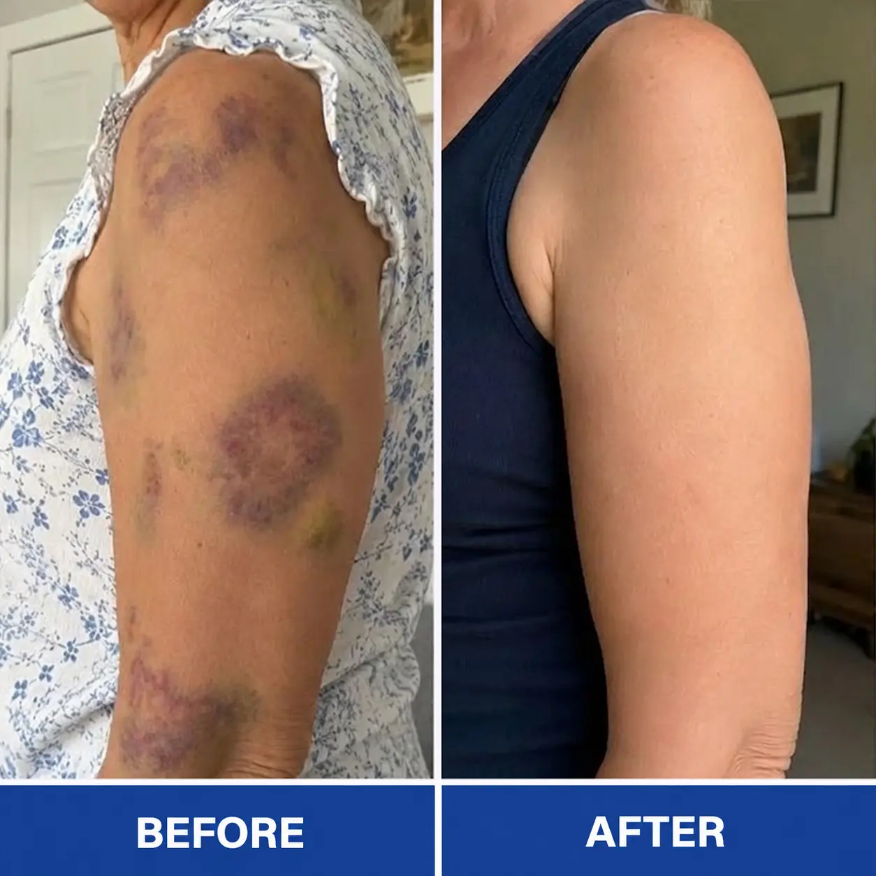 BruiseRepair & Skin-Strengthening Cream - Image 9