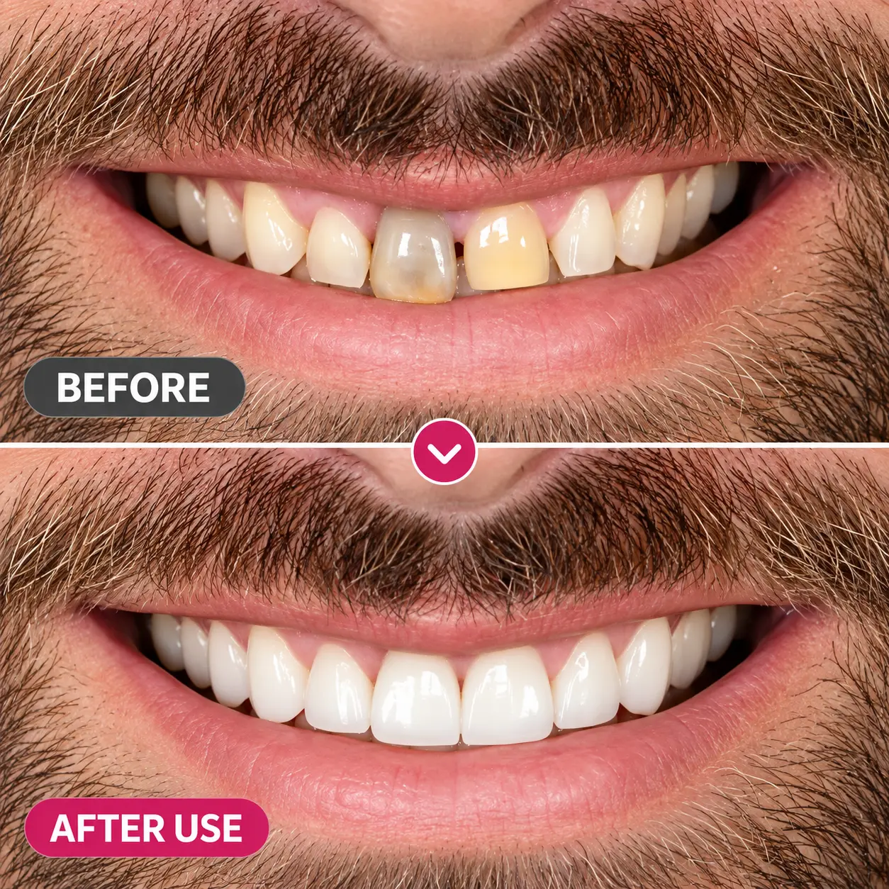 Cavity-Repair Natural Gel - Image 5