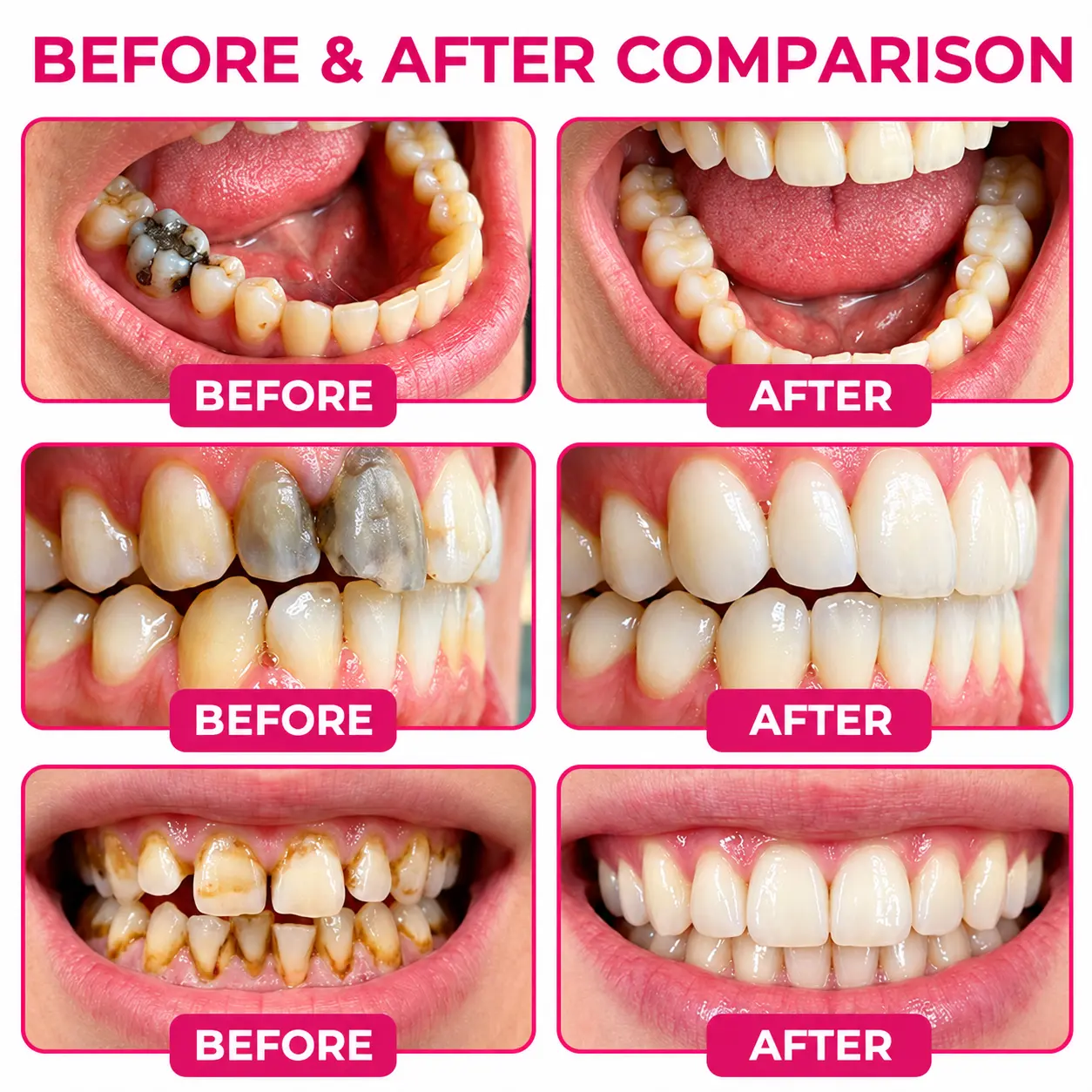 Cavity-Repair Natural Gel - Image 8