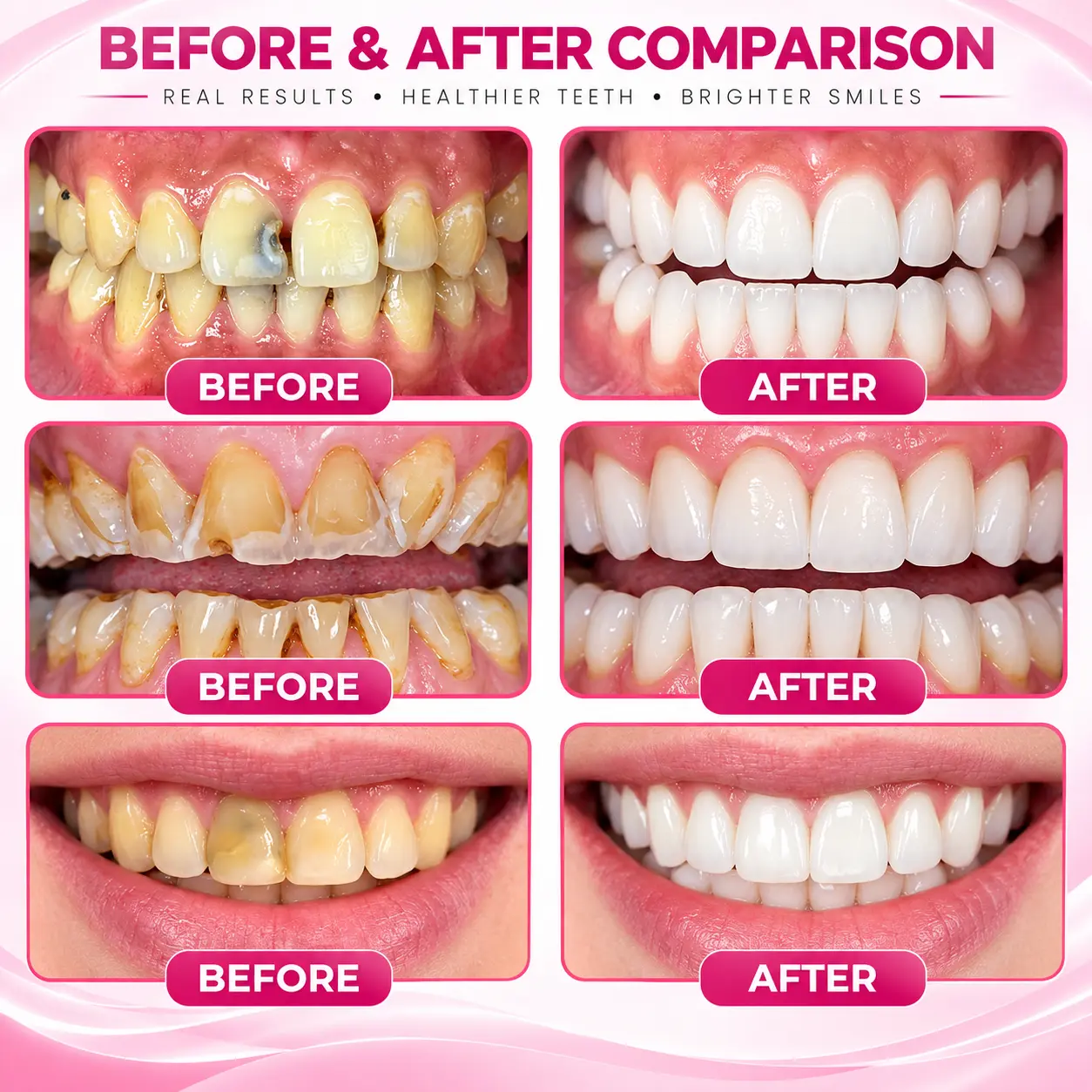 Cavity-Repair Natural Gel - Image 9