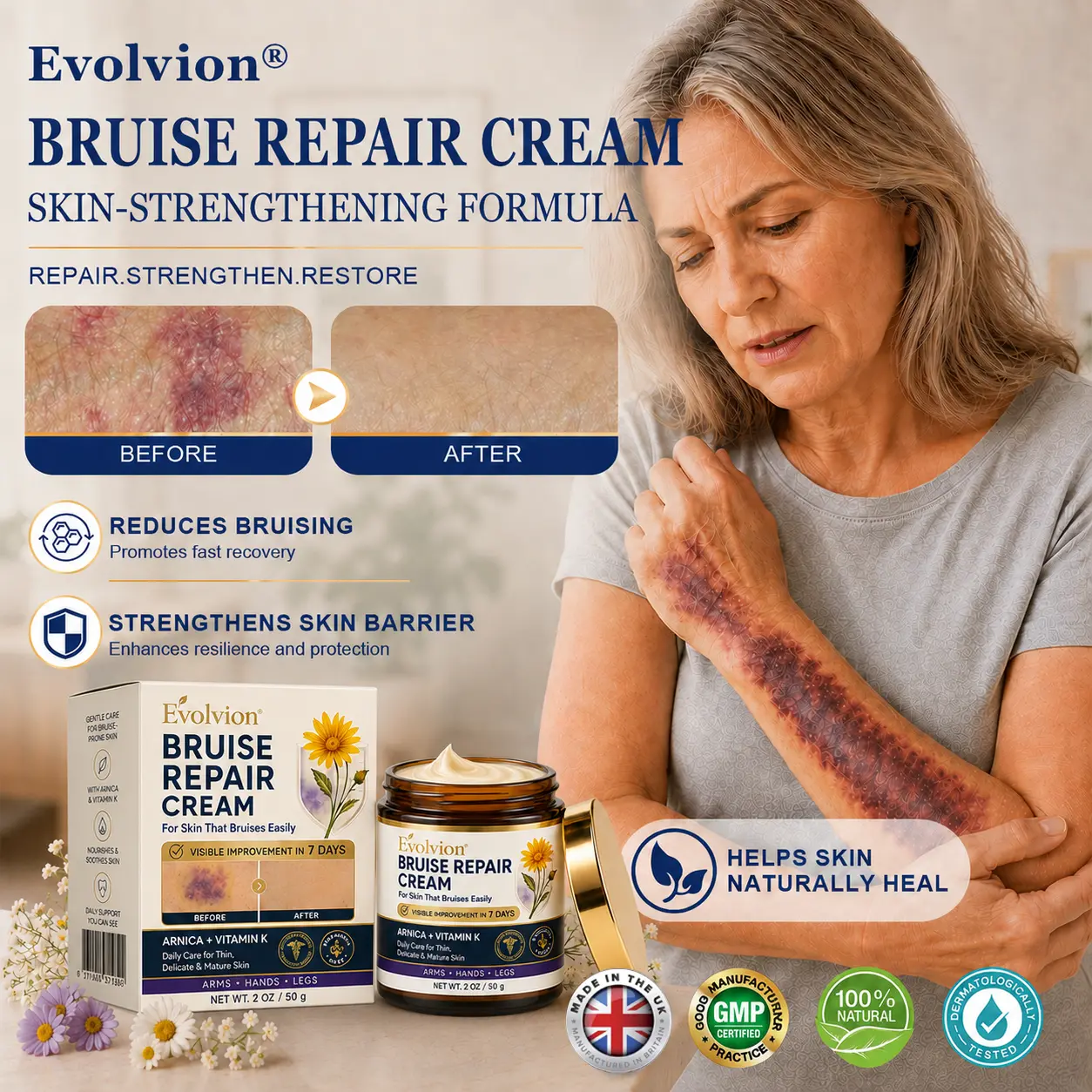 Bruise Repair Cream
