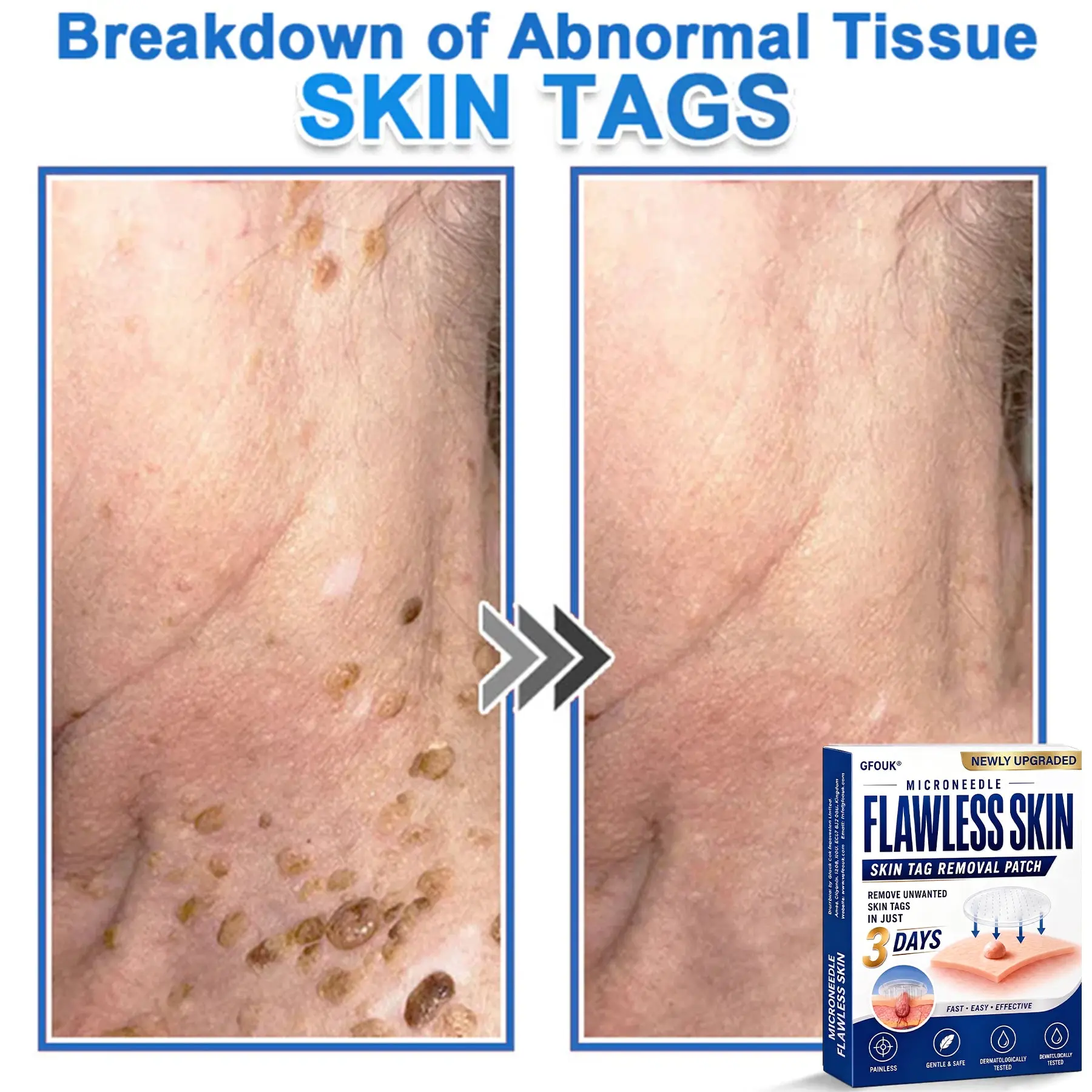 2026 Newly Upgraded 2-in-1 Hydrocolloid Patches - Image 11