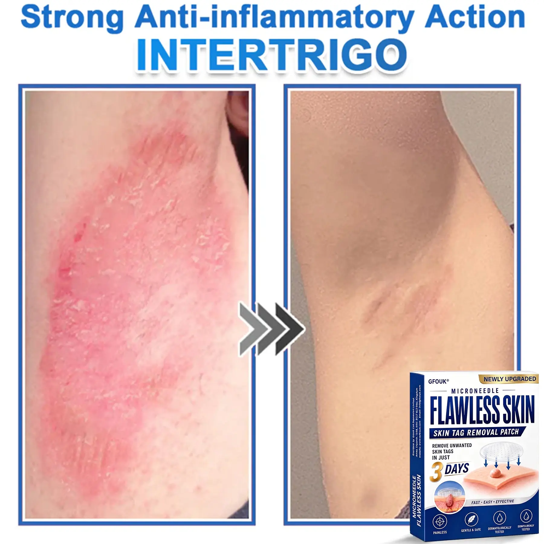 2026 Newly Upgraded 2-in-1 Hydrocolloid Patches - Image 12