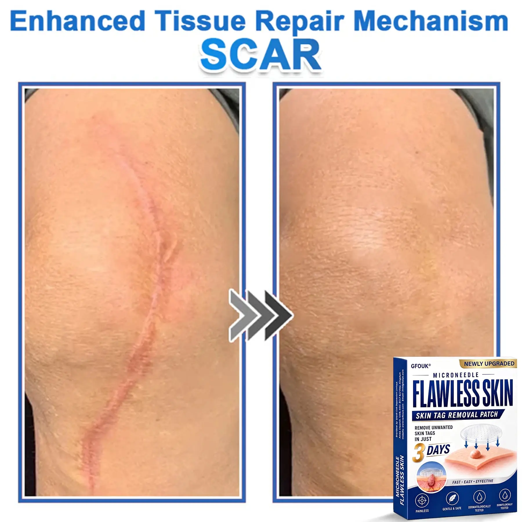 2026 Newly Upgraded 2-in-1 Hydrocolloid Patches - Image 13