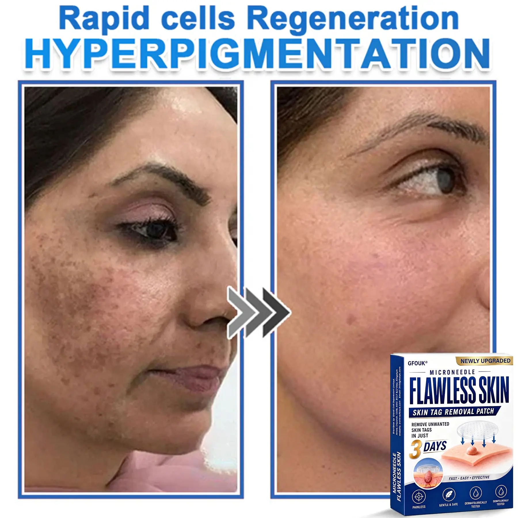 2026 Newly Upgraded 2-in-1 Hydrocolloid Patches - Image 14