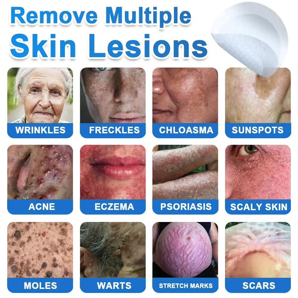2026 Newly Upgraded 2-in-1 Hydrocolloid Patches - Image 2