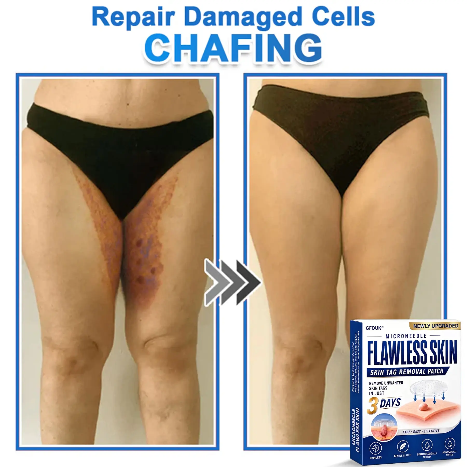 2026 Newly Upgraded 2-in-1 Hydrocolloid Patches - Image 4