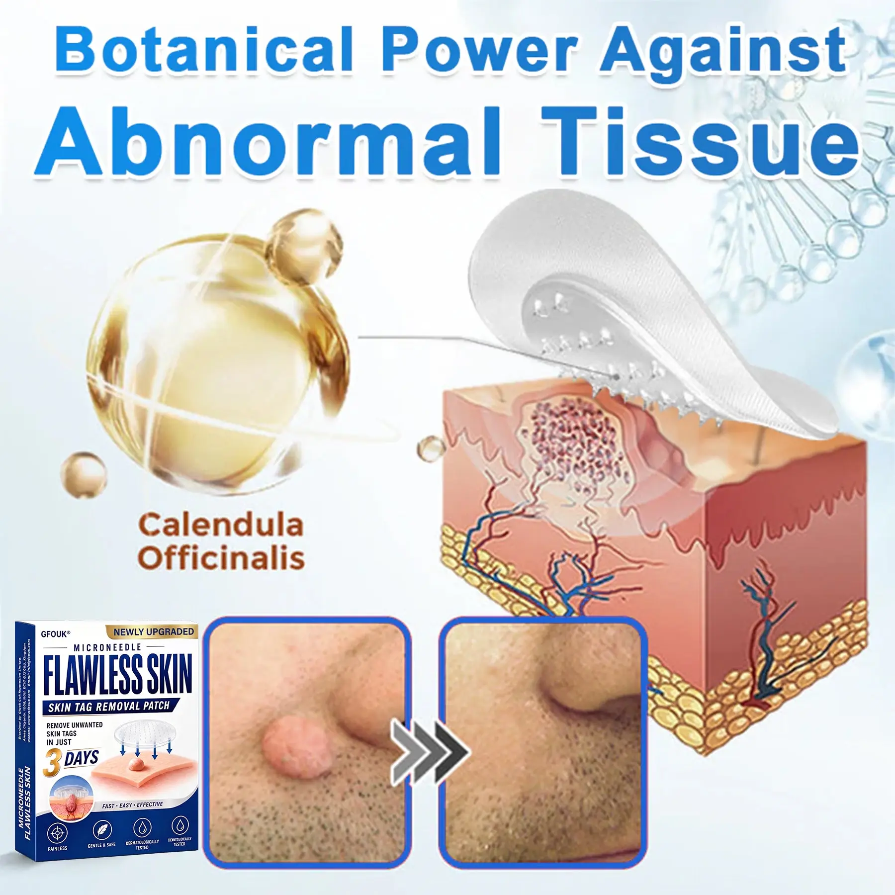 2026 Newly Upgraded 2-in-1 Hydrocolloid Patches - Image 5
