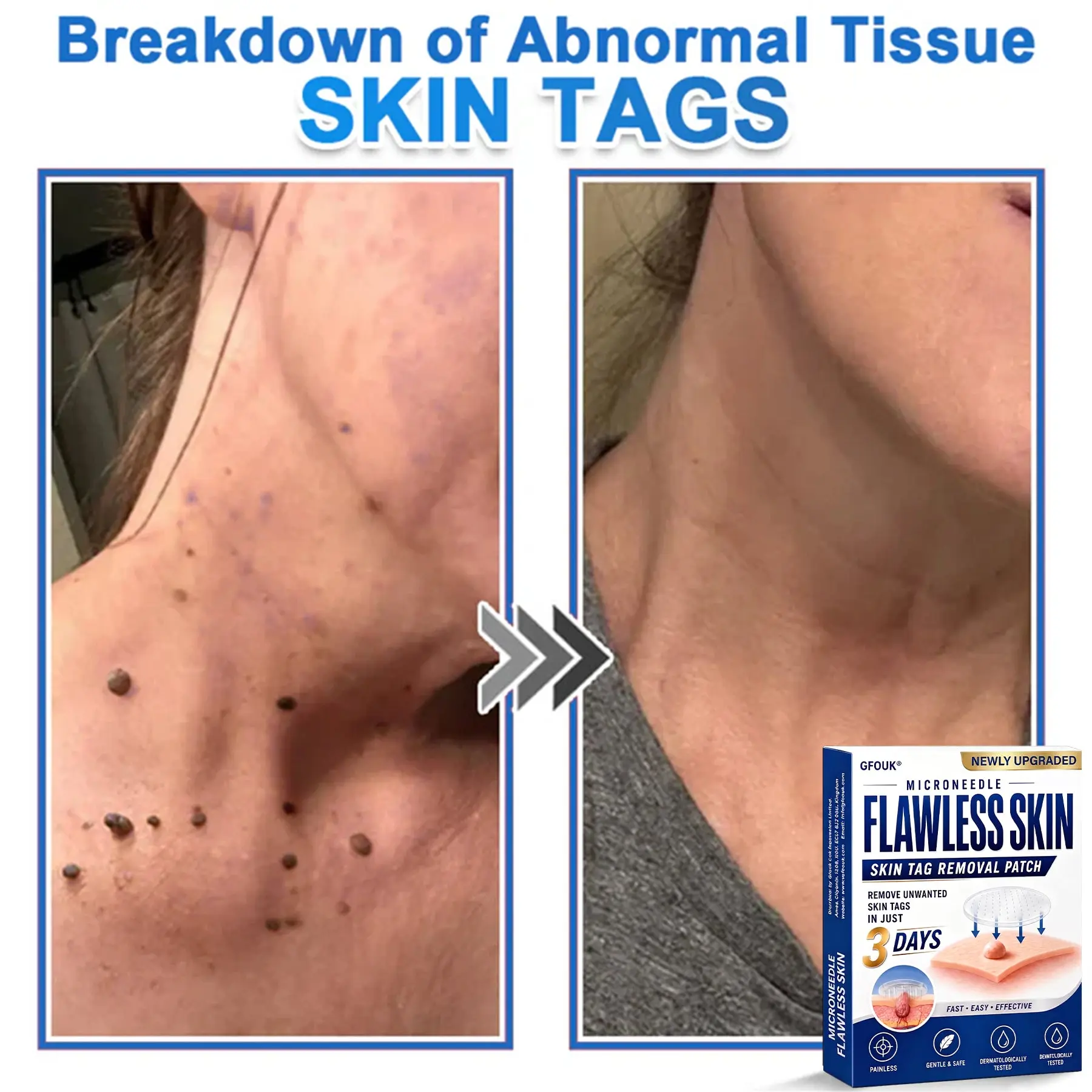 2026 Newly Upgraded 2-in-1 Hydrocolloid Patches - Image 6