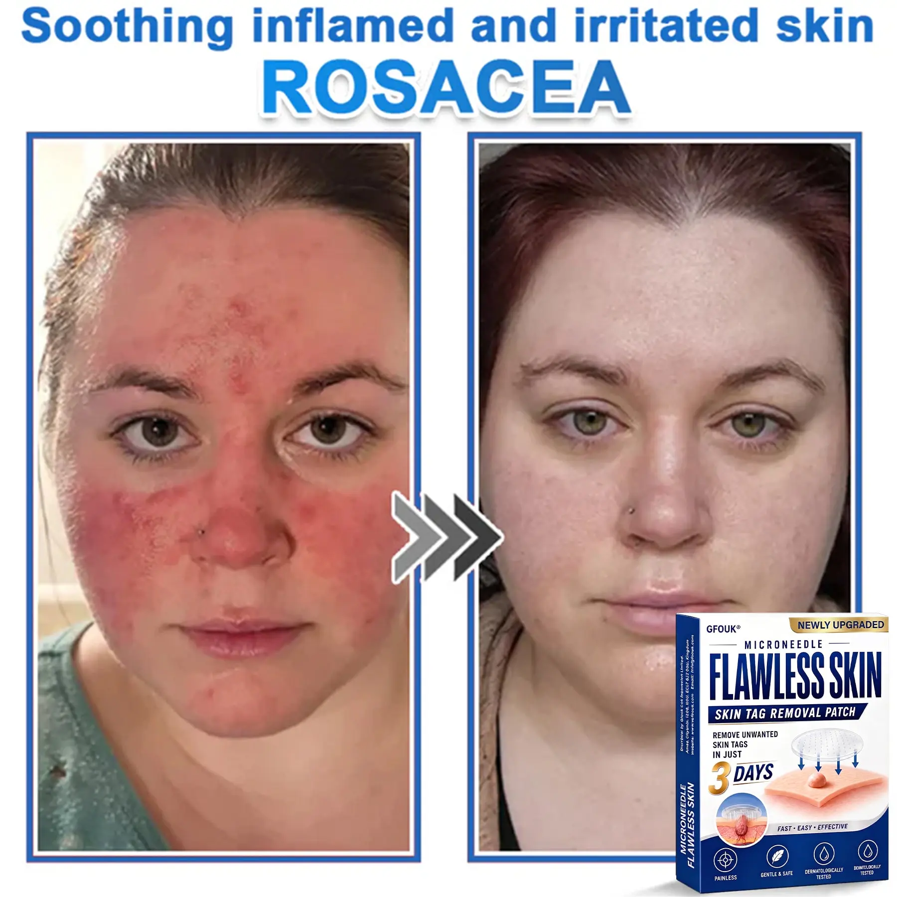 2026 Newly Upgraded 2-in-1 Hydrocolloid Patches - Image 7
