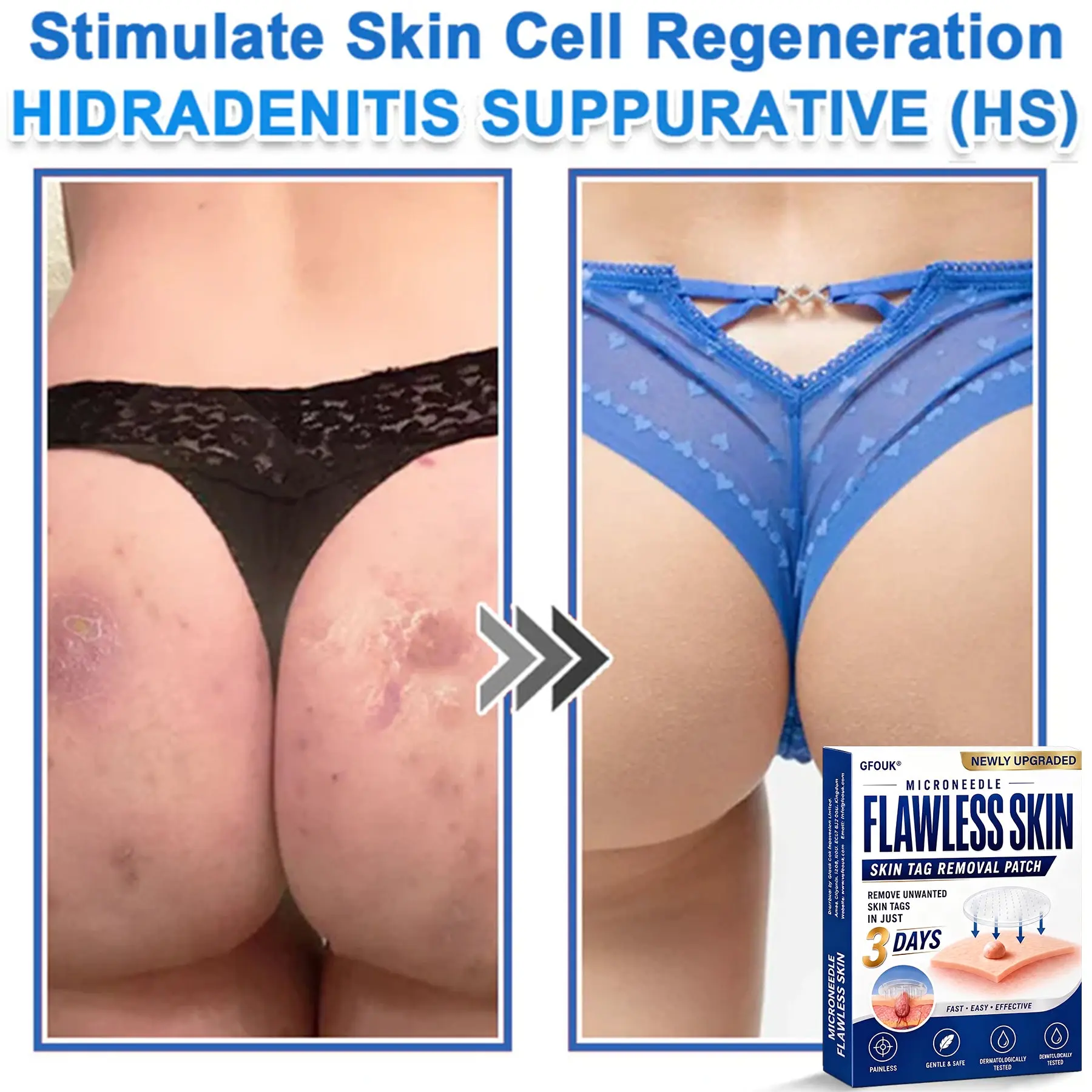 2026 Newly Upgraded 2-in-1 Hydrocolloid Patches - Image 9