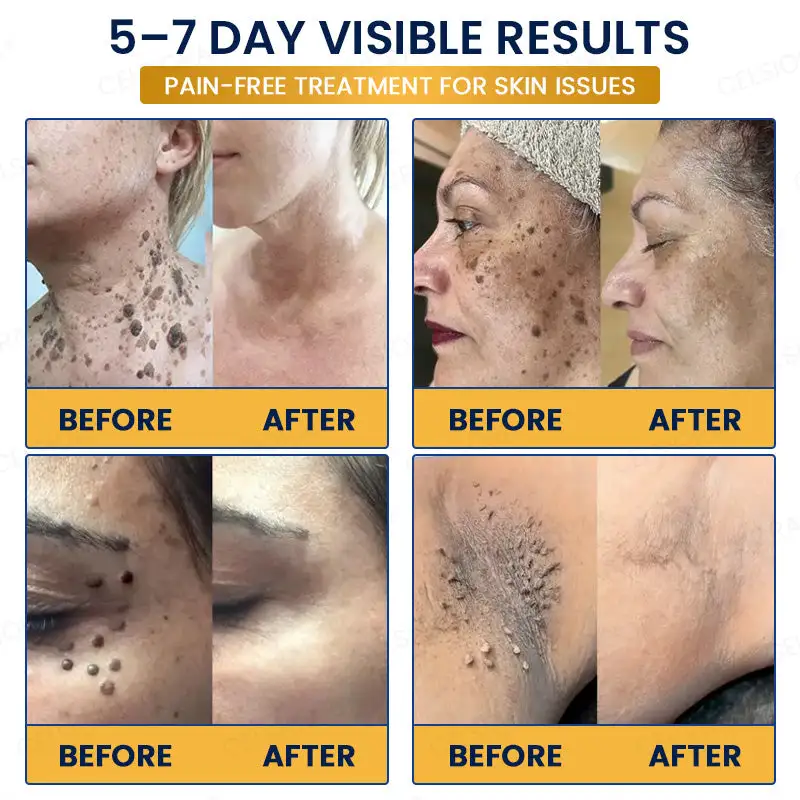 7-Day Skin Removal Patch - Image 2