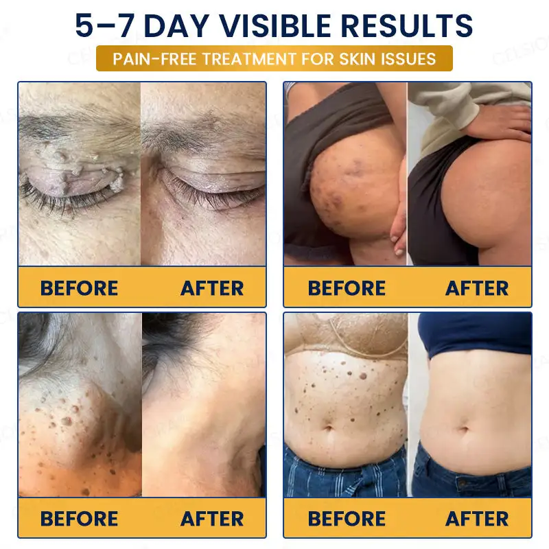 7-Day Skin Removal Patch - Image 3