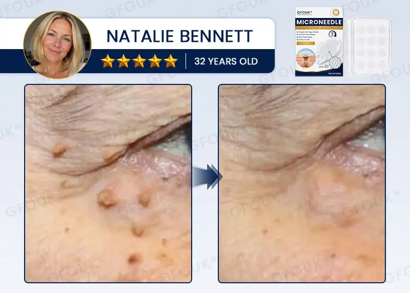 7-Day Skin Removal Patch - Image 4