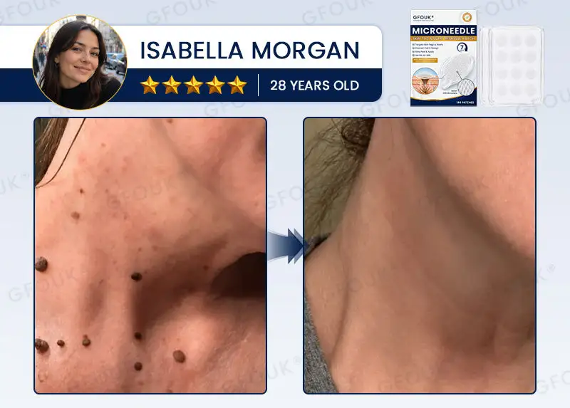 7-Day Skin Removal Patch - Image 5