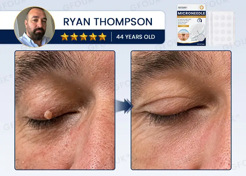 7-Day Skin Removal Patch - Image 6