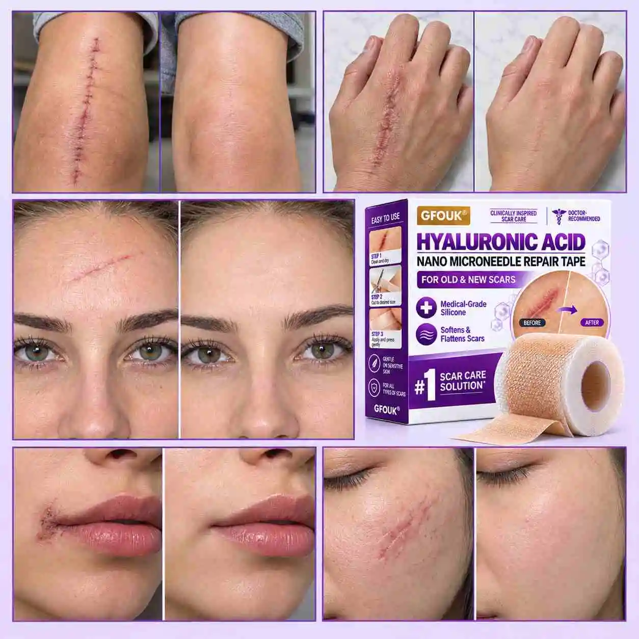 Hyaluronic Acid Nano Repair Tape - Image 2