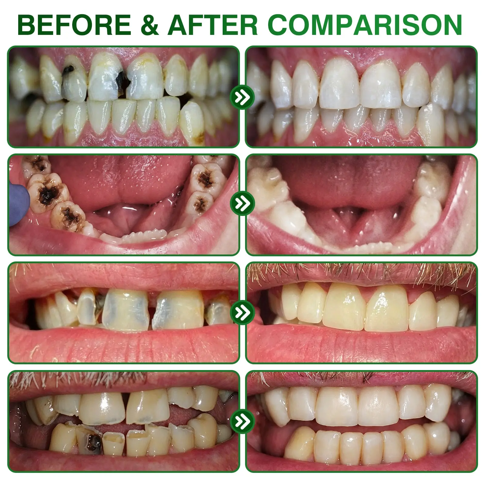 CavityReverse Gel - Image 3