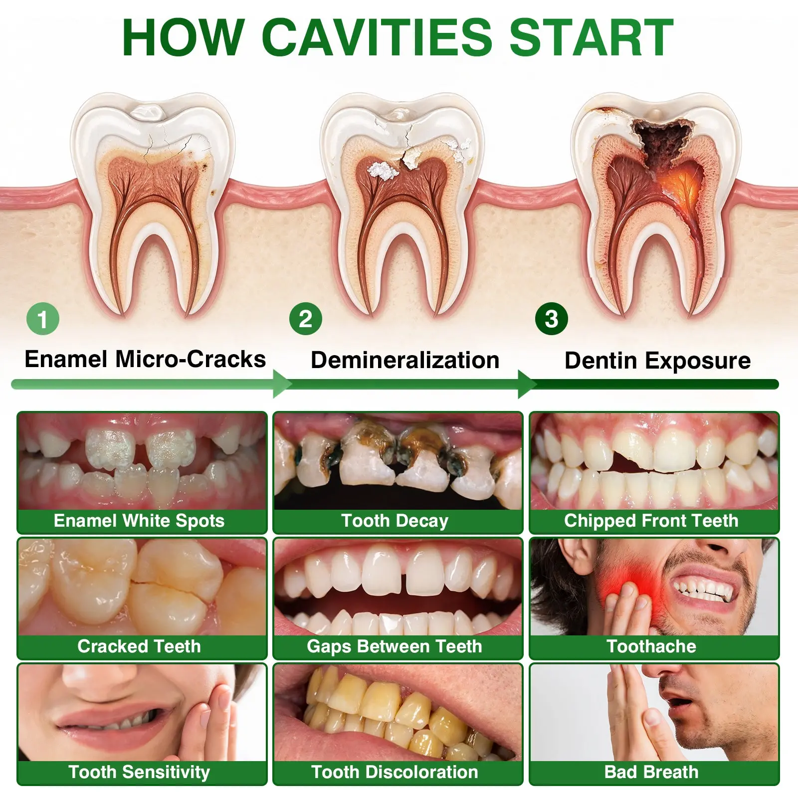 CavityReverse Gel - Image 5