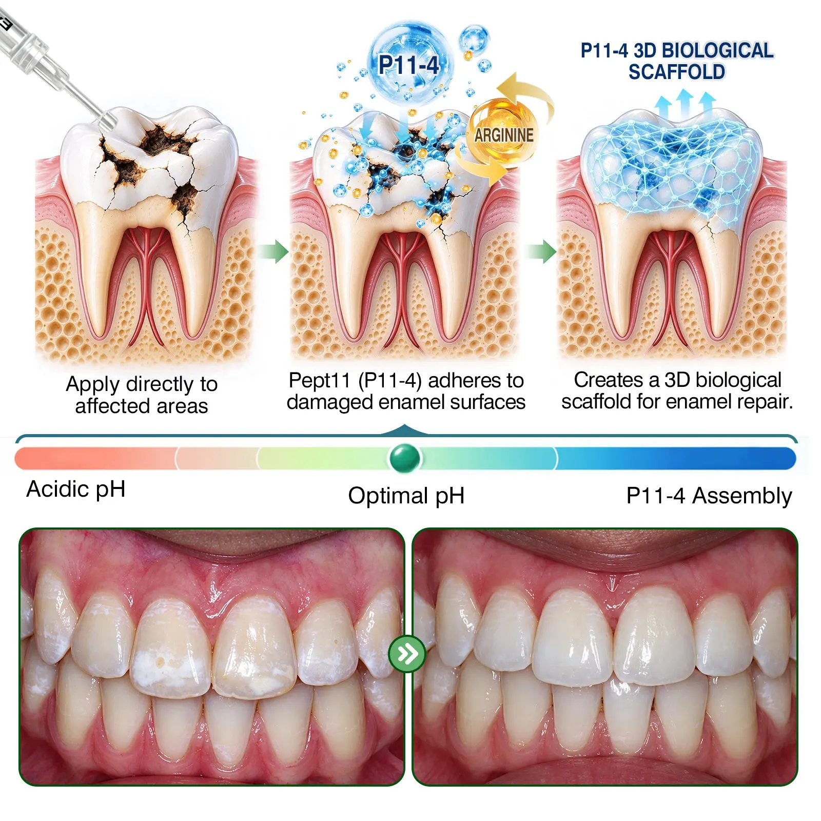 CavityReverse Gel - Image 6