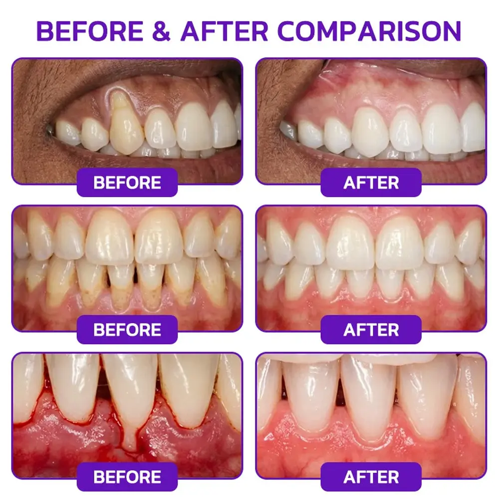 VioGum Rescue Gel - Image 2