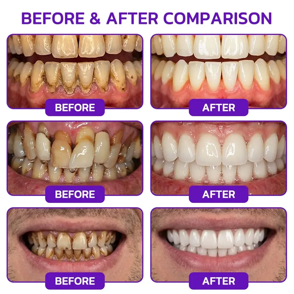 VioGum Rescue Gel - Image 3